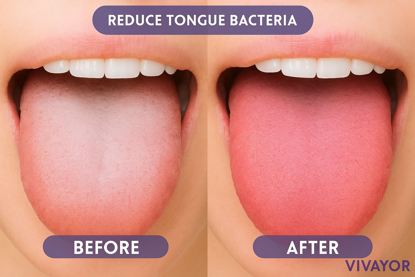 Probiotic Fresh Breath Spray™
