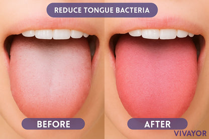 Probiotic Fresh Breath Spray™